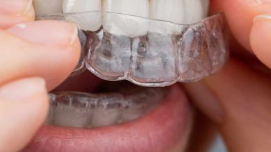 The Evolution of Clear Fusion Aligners: Revolutionizing Orthodontic Treatment