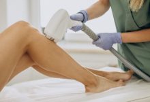 A Comprehensive Guide to Laser Hair Removal