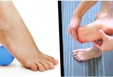 Where to Find Effective Plantar Fasciitis Relief Sleeves in Scottsdale, AZ
