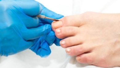 Where to Find Expert Podiatrist Ingrown Toenail Removal