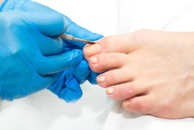 Where to Find Expert Podiatrist Ingrown Toenail Removal