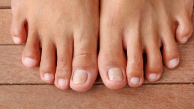 Where to Find Toe Nail Fungus Treatment in AZ