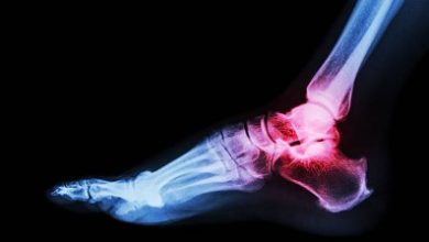 How Can Pain in Side of Foot Be Prevented