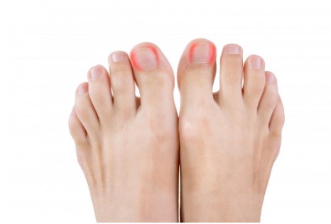 How Serious Is Pus Under the Toenail and What Are the Treatment Options