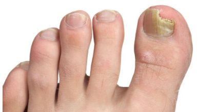 How To Heal A Toe Infection See