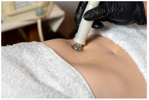 What is liquid Lipo injections